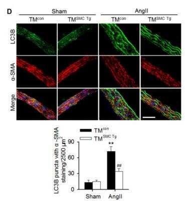 Immunofluorescent Staining of LC3B in Mouse Aortas