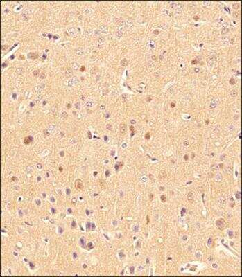 Immunohistochemical Staining of LC3 in Mouse Brain