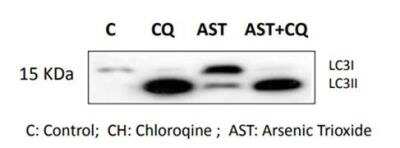 Western Blot Detection of LC3B in SV-K1 Cell Line