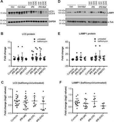 Western Blotting of LC3B-I and LC3B-II in Human Dopaminergic Neurons