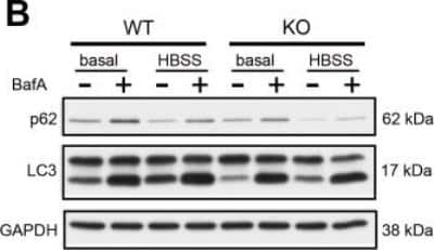 Detection of LC3 in WT and KO NSC34 Cells in Western Blot.