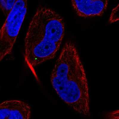 Immunocytochemistry/ Immunofluorescence: LC3C Antibody [NBP2-57604]