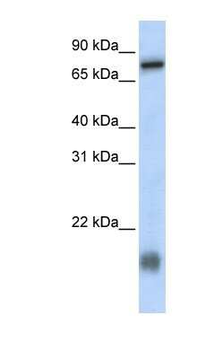 Western Blot: LCA5L Antibody [NBP1-70597]