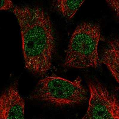 Immunocytochemistry/ Immunofluorescence: LCAT Antibody [NBP2-76537]