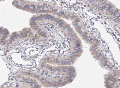 Immunohistochemistry-Paraffin: LCLAT1 Antibody [NBP1-89204]