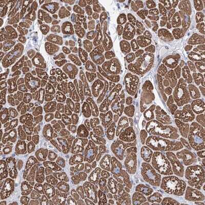 Immunohistochemistry-Paraffin: LCLAT1 Antibody [NBP1-89204]