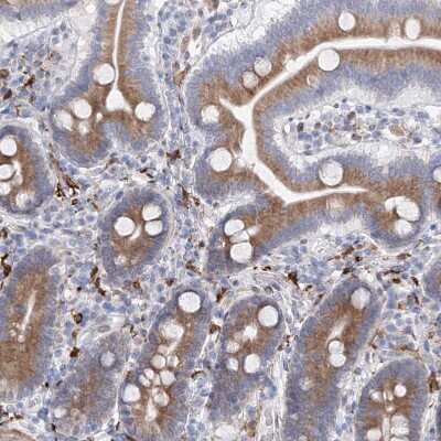 Immunohistochemistry-Paraffin: LCLAT1 Antibody [NBP1-89204]