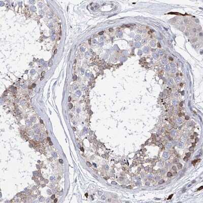 Immunohistochemistry-Paraffin: LCLAT1 Antibody [NBP1-89204]