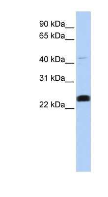 Western Blot: LCLAT1 Antibody [NBP1-59347]