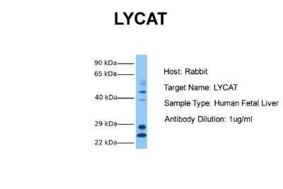 Western Blot: LCLAT1 Antibody [NBP1-59347]