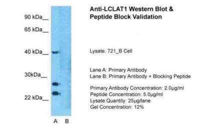 Western Blot: LCLAT1 Antibody [NBP1-59347]