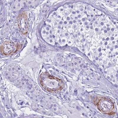 Immunohistochemistry-Paraffin: LCMT1 Antibody [NBP2-14189]