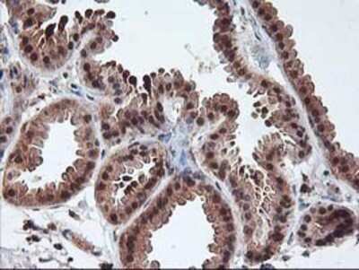 Immunohistochemistry: LCMT1 Antibody (OTI2C9) - Azide and BSA Free [NBP2-71927]
