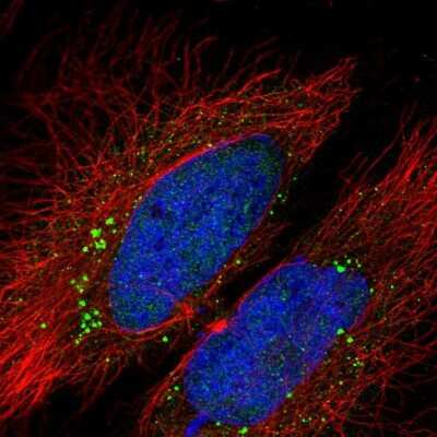 Immunocytochemistry/ Immunofluorescence: LCMT2 Antibody [NBP2-56384]