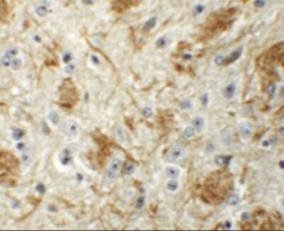 Immunohistochemistry: LCMT2 Antibody - BSA Free [NBP1-76585]