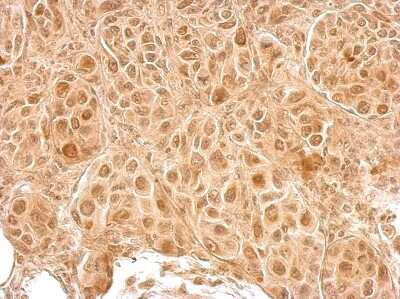 Immunohistochemistry-Paraffin: LCMT2 Antibody [NBP2-19340]