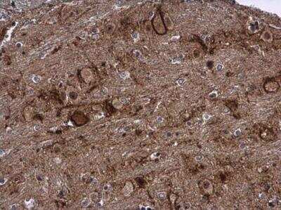 Immunohistochemistry-Paraffin: LCMT2 Antibody [NBP2-19340]