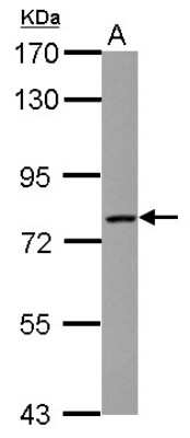 Western Blot: LCMT2 Antibody [NBP2-19340]
