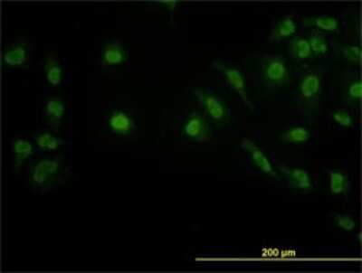 Immunocytochemistry/ Immunofluorescence: LDB2 Antibody (1A3) [H00009079-M02]
