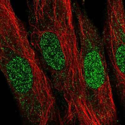 Immunocytochemistry/ Immunofluorescence: LDB2 Antibody [NBP2-55705]