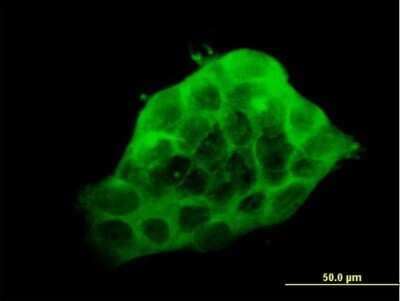 Immunocytochemistry/ Immunofluorescence: LDB3 Antibody (3C8) [H00011155-M06]