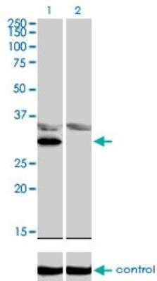Western Blot: LDB3 Antibody (3C8) [H00011155-M06]