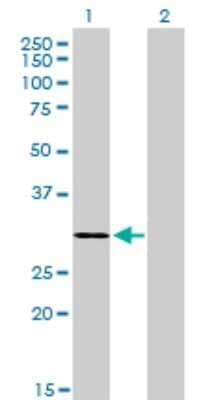 Western Blot: LDB3 Antibody (3C8) [H00011155-M06]