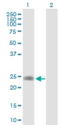 Western Blot: LDHAL6A Antibody [H00160287-B01P]