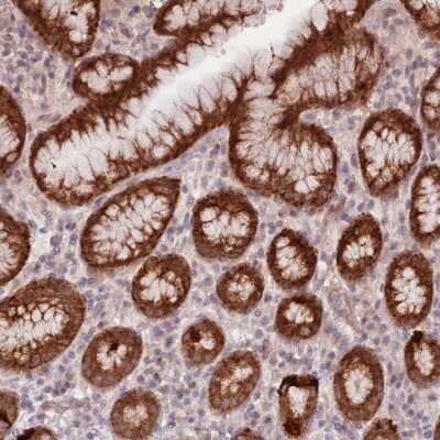 Immunohistochemistry-Paraffin: LDHD Antibody [NBP2-30523]