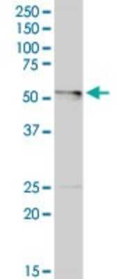 Western Blot: LDHD Antibody [H00197257-D01P]