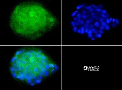 Immunocytochemistry/ Immunofluorescence: LDLR Antibody (C7) [NBP1-78159]