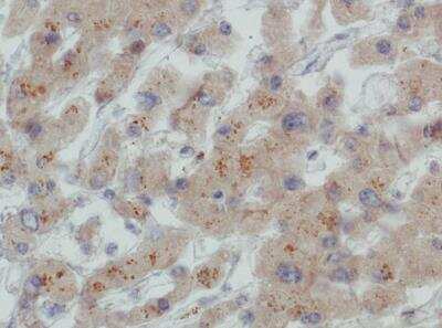 Immunohistochemistry: LDLR Antibody (C7) [NBP1-78159]