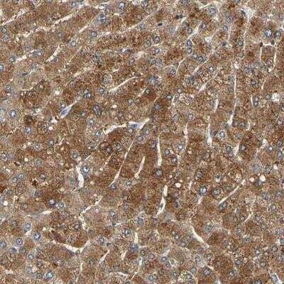 Immunohistochemistry-Paraffin: LDLR Antibody [NBP1-87476]