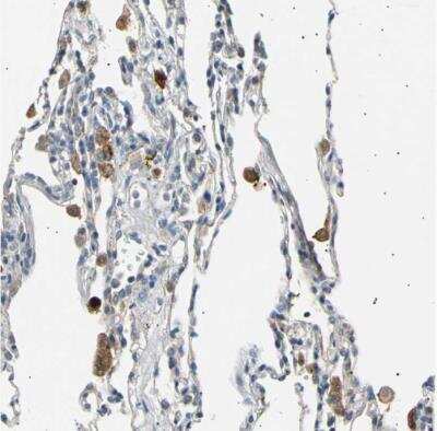 Immunohistochemistry-Paraffin: LDLR Antibody [NBP1-87476]