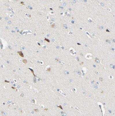 Immunohistochemistry-Paraffin: LDLR Antibody [NBP1-87476]