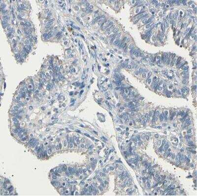Immunohistochemistry-Paraffin: LDLR Antibody [NBP1-87476]