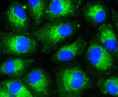 Immunocytochemistry/ Immunofluorescence: LDLR Antibody (SJ0197) [NBP2-67414]