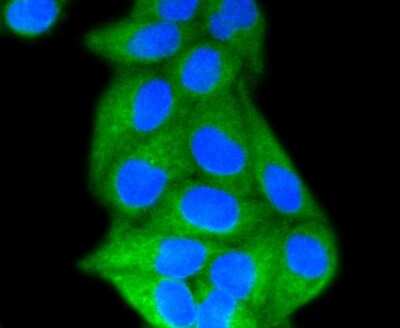 Immunocytochemistry/ Immunofluorescence: LDLR Antibody (SJ0197) [NBP2-67414]