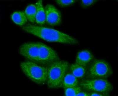 Immunocytochemistry/ Immunofluorescence: LDLR Antibody (SJ0197) [NBP2-67414]