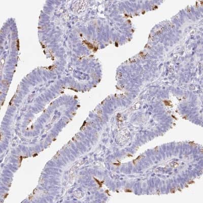 Immunohistochemistry-Paraffin: LDLRAD1 Antibody [NBP2-49047]
