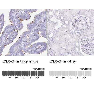 Immunohistochemistry-Paraffin: LDLRAD1 Antibody [NBP2-49047]
