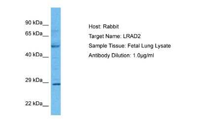 Western Blot: LDLRAD2 Antibody [NBP2-83139]