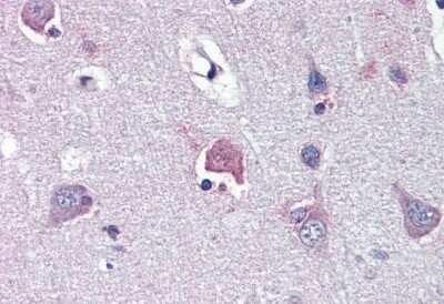 Immunohistochemistry: LDOC1 Antibody [NBP1-80323]
