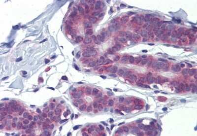 Immunohistochemistry: LDOC1 Antibody [NBP1-80323]