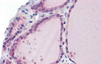 Immunohistochemistry: LDOC1 Antibody [NBP1-80323]