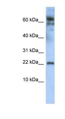 Western Blot: LDOC1 Antibody [NBP1-80323]