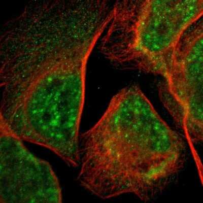 Immunocytochemistry/ Immunofluorescence: LDOC1L Antibody [NBP1-85207]