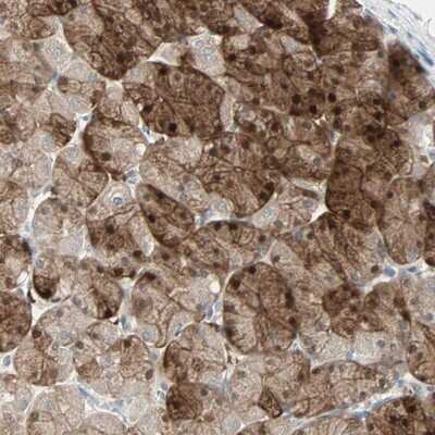 Immunohistochemistry-Paraffin: LDOC1L Antibody [NBP1-85207]