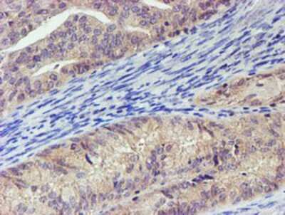 Immunohistochemistry-Paraffin: LECT2 Antibody (OTI2A11) [NBP2-01632]
