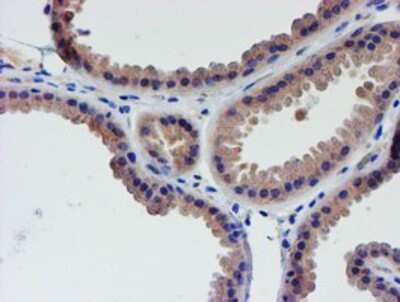 Immunohistochemistry-Paraffin: LECT2 Antibody (OTI2A11) [NBP2-01632]
